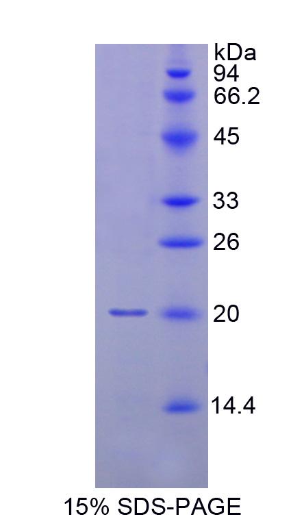 肌球蛋白轻链7(MYL7)重组蛋白,Recombinant Myosin Light Chain 7, Regulatory (MYL7)