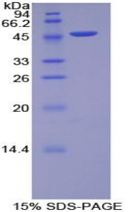 肌球蛋白輕鏈6B(MYL6B)重組蛋白,Recombinant Myosin Light Chain 6B, Alkali, Smooth Muscle And Non Muscle (MYL6B)