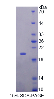 肌球蛋白輕鏈6(MYL6)重組蛋白,Recombinant Myosin Light Chain 6, Alkali, Smooth Muscle And Non Muscle (MYL6)