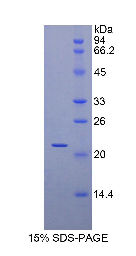 肌球蛋白轻链3(MYL3)重组蛋白,Recombinant Myosin Light Chain 3, Alkali, Ventricular, Slow Skeletal (MYL3)