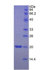 肌球蛋白轻链2(MYL2)重组蛋白,Recombinant Myosin Light Chain 2 (MYL2)