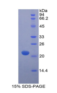 肌球蛋白轻链12A(MYL12A)重组蛋白,Recombinant Myosin Light Chain 12A (MYL12A)