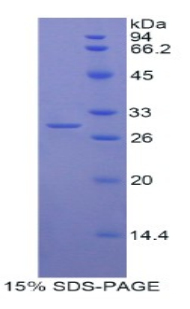 肌球蛋白ⅠG(MYO1G)重组蛋白,Recombinant Myosin IG (MYO1G)