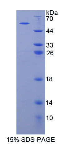 肌球蛋白ⅠC(MYO1C)重组蛋白,Recombinant Myosin IC (MYO1C)