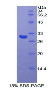 肌球蛋白ⅠA(MYO1A)重组蛋白,Recombinant Myosin IA (MYO1A)