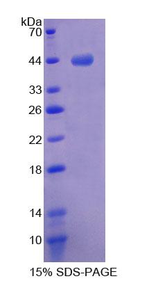 肌侵蛋白(MTPN)重组蛋白,Recombinant Myotrophin (MTPN)