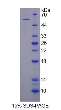 肌腱蛋白X(TNX)重组蛋白,Recombinant Tenascin X (TNX)