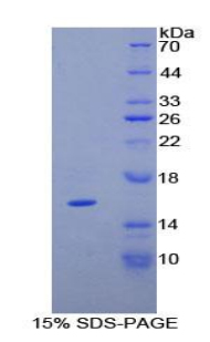 肌腱蛋白C(TNC)重组蛋白,Recombinant Tenascin C (TNC)