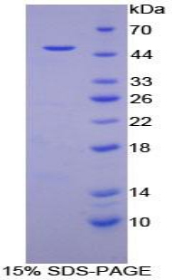 肌红蛋白(MYO)重组蛋白,Recombinant Myoglobin (MYO)