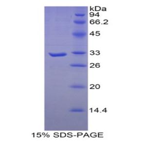 肌球蛋白重链16(MYH16)重组蛋白,Recombinant Myosin Heavy Chain 16 (MYH16)