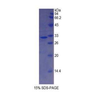 肌球蛋白重链14(MYH14)重组蛋白