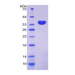 肌球蛋白重链10(MYH10)重组蛋白,Recombinant Myosin Heavy Chain 10, Non Muscle (MYH10)