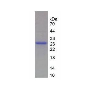 肌球蛋白重链1(MYH1)重组蛋白,Recombinant Myosin Heavy Chain 1 (MYH1)