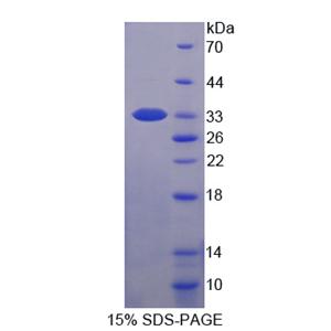 肌球蛋白轻链激酶2(MYLK2)重组蛋白,Recombinant Myosin Light Chain Kinase 2 (MYLK2)