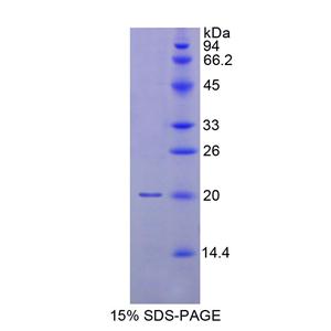 肌球蛋白轻链7(MYL7)重组蛋白,Recombinant Myosin Light Chain 7, Regulatory (MYL7)