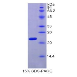 肌球蛋白轻链4(MYL4)重组蛋白