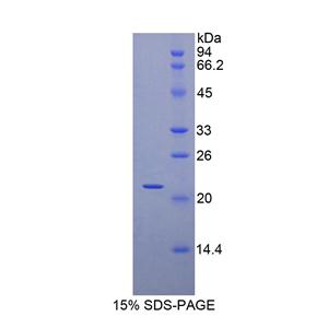 肌球蛋白轻链3(MYL3)重组蛋白,Recombinant Myosin Light Chain 3, Alkali, Ventricular, Slow Skeletal (MYL3)