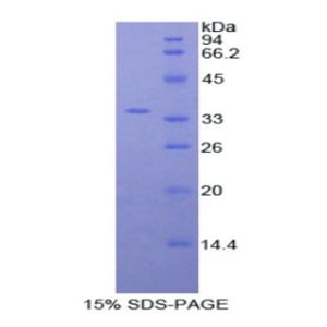 肌球蛋白ⅠF(MYO1F)重组蛋白,Recombinant Myosin IF (MYO1F)