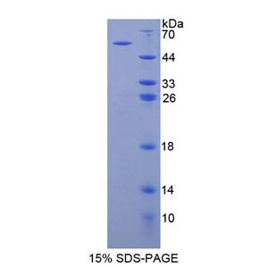 肌球蛋白ⅠC(MYO1C)重组蛋白,Recombinant Myosin IC (MYO1C)