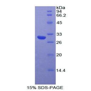 肌球蛋白ⅠA(MYO1A)重组蛋白,Recombinant Myosin IA (MYO1A)