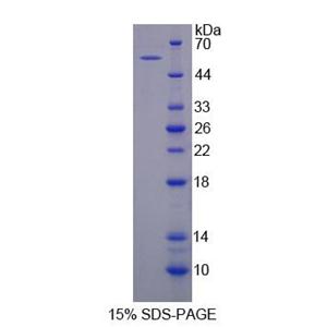 肌腱蛋白X(TNX)重组蛋白,Recombinant Tenascin X (TNX)