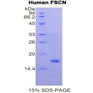 肌动蛋白束蛋白(FSCN)重组蛋白