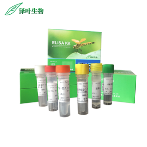 腺病毒D型染料法荧光定量PCR试剂盒,Adenovirus