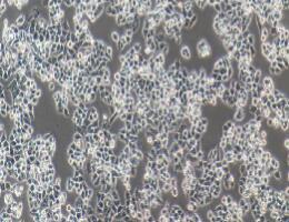 人卵巢癌细胞；A2780
