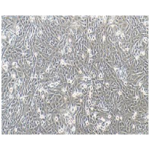 人骨肉瘤细胞；143B,143B