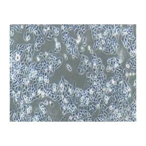 人子宫内膜腺癌(转移)细胞；AN3 CA