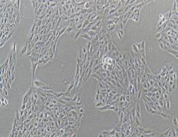 人视网膜上皮细胞；ARPE-19