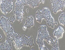 人乳腺导管瘤细胞；BT-474