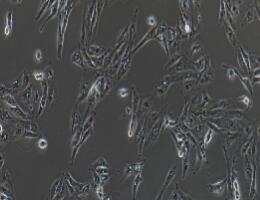 人肾透明细胞癌皮肤转移细胞；Caki-1