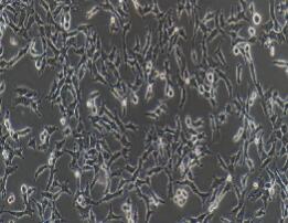 人卵巢透明细胞癌细胞；ES-2