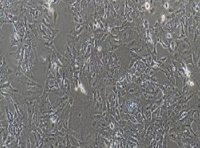人胆管细胞型肝癌细胞；HCCC-9810