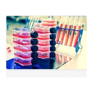人子宫鳞癌细胞（高分化）；HCC94