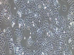 人非小细胞肺癌细胞；NCI-H23