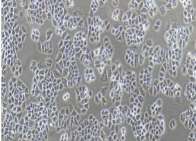 人大细胞肺癌细胞；NCI-H460