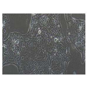 人肺腺癌细胞；NCI-H441