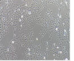 人卵巢腺癌細(xì)胞；SK-OV-3