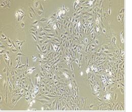 人膀胱上皮永生化细胞；SV-HUC-1