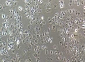 人大细胞肺癌细胞；NCI-H661