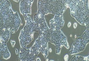 人胃癌细胞；NCI-N87