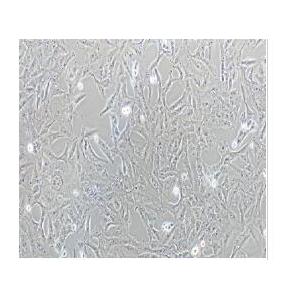 人脑胶质母细胞瘤细胞；T98G