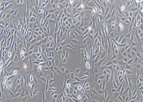 人子宫颈鳞状细胞癌细胞；SiHa