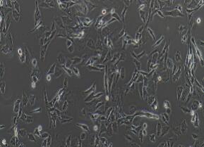 大鼠肾小球系膜细胞；HBZY-1