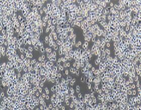 褐鼠胰岛素瘤上皮细胞；RIN-m5F