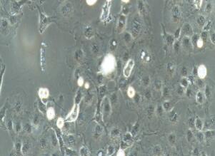 非洲绿猴肾细胞；Cos-7