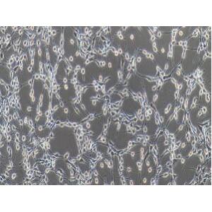 小鼠胚胎成纤维细胞；NIH/3T3