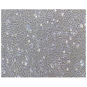 小鼠肾小球系膜细胞；SV40 MES 13